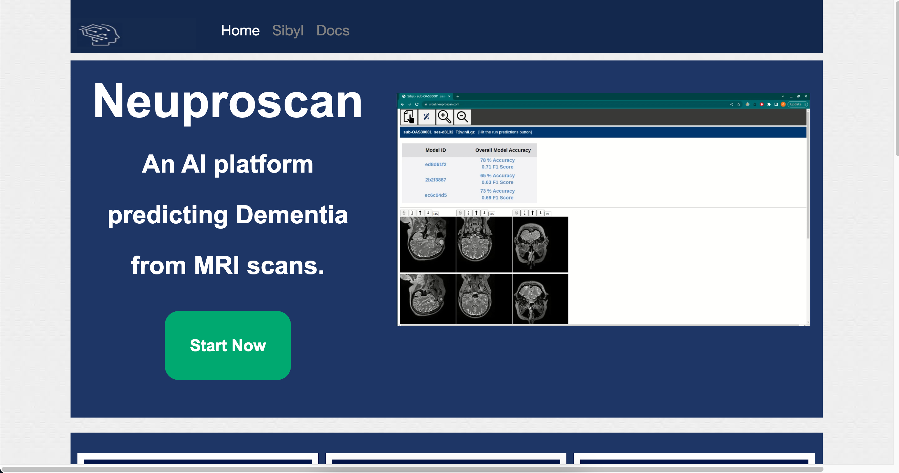 Unlocking the Secrets of Alzheimer’s: How AI-Powered NeuProScan is Redefining Early Diagnosis